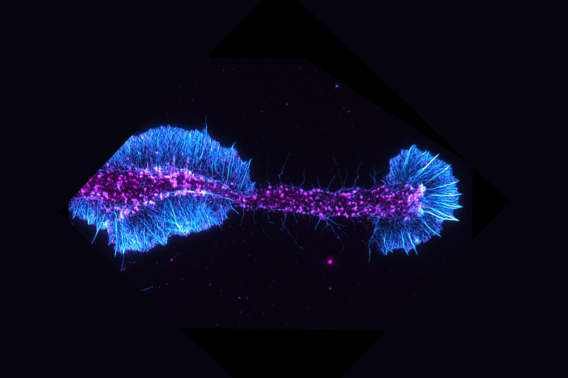 Image of actin filaments (cyan) and an actin regulatory protein (magenta) in a differentiating oligodendrocyte. Credit: Andrew Olson and Brad Zuchero, Neuroscience imaging core (before it was called Wu Tsai Nero’s Neuroscience Microscopy Service).